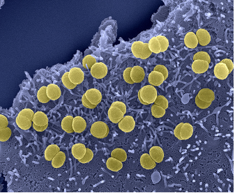 microb r img 1